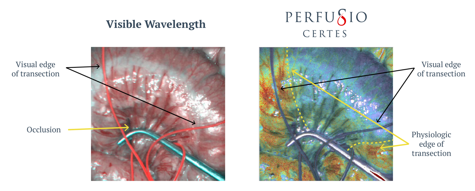 Perfusio Gastroenterology Comparison Figure