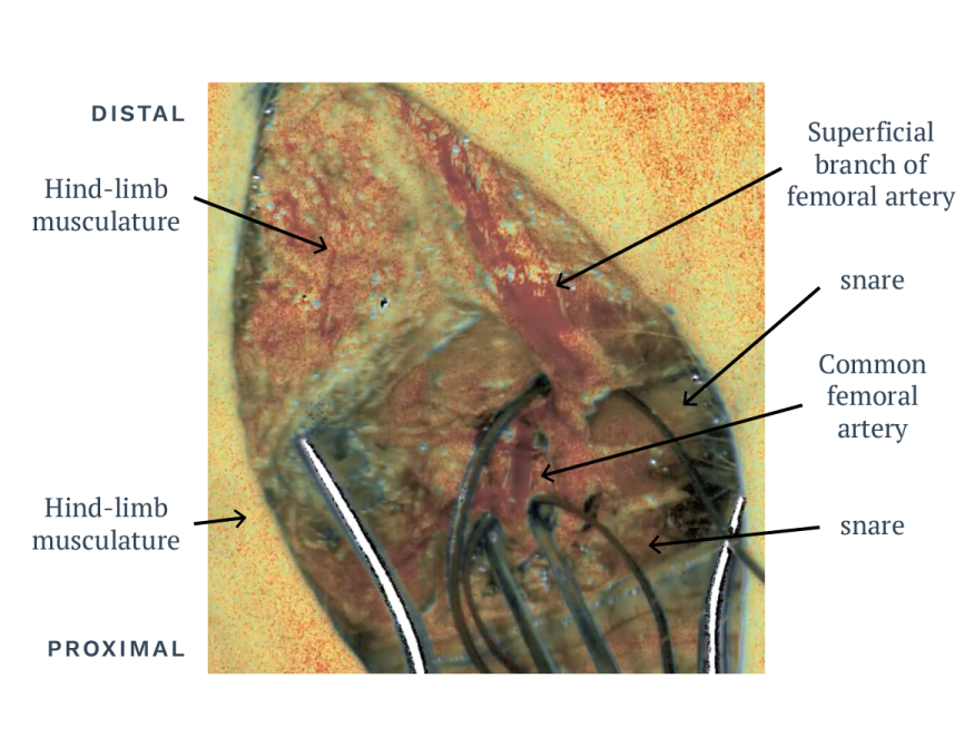 Peripheral Vascular Diagram