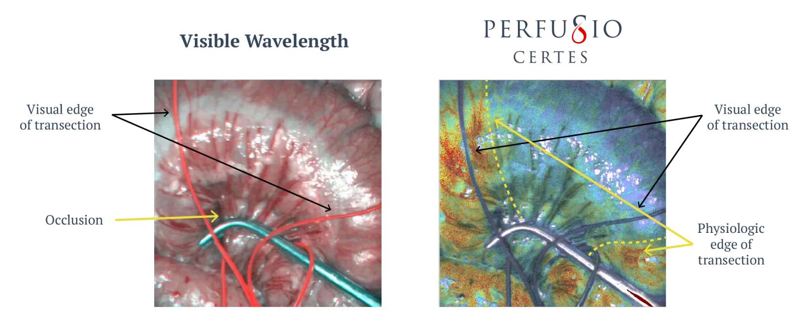 gastroenterologyComparison Perfusio Gastroenterology Comparison Figure